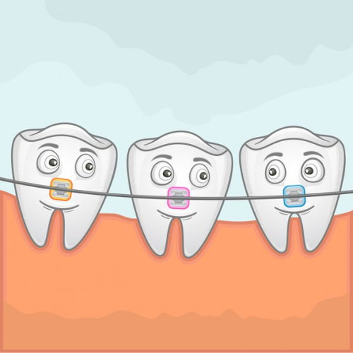 Ортодонтия: сведения и техническое оснащение